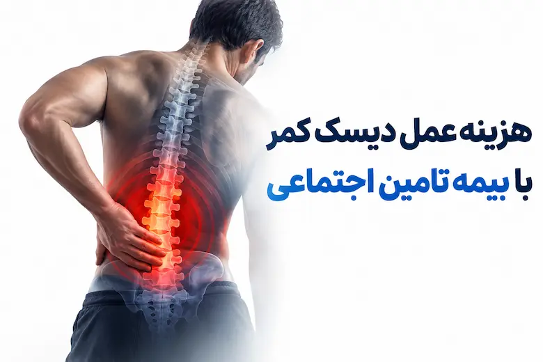 تصویری از هزینه عمل دیسک کمر با بیمه تامین اجتماعی