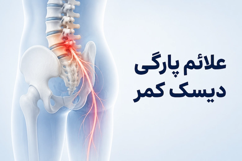 تصویری از علائم پارگی دیسک کمر