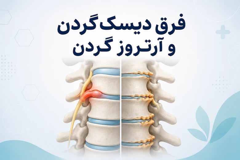 تصویری از فرق دیسک گردن و آرتروز گردن